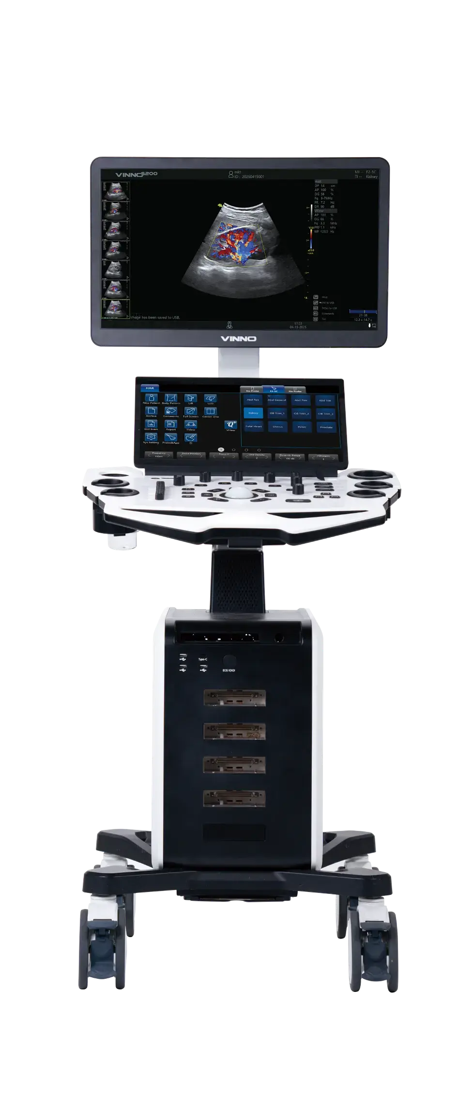 VINNO S200 — mid-range cart ultrasound